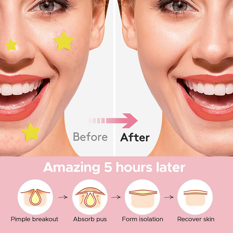 600Pcs/set Star Pimple Patch A - Beauty For You Makeup 评论和价格